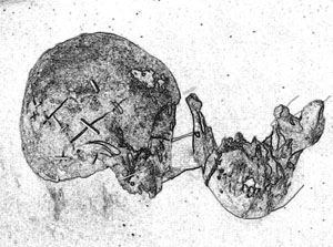 illustration of skull of adult male