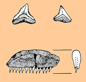 Image of blood-letting tools.