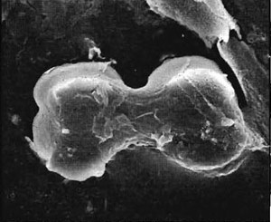 JW8-phytoliths-panicoid
