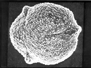 Quercus-pollen-SEM